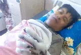 Bị phóng điện, người đàn ông bỏng nặng cả hai tay