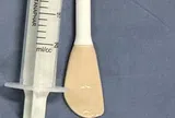 Người phụ nữ 31 tuổi nuốt bàn chải dài 20cm vào bụng