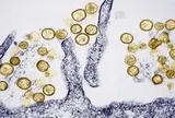 Những điều cần biết về virus Hanta