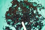 Đau bụng suốt nhiều tháng, người đàn ông 43 tuổi sốc nặng khi bác sĩ gắp ra thứ "đáng sợ" trong bụng