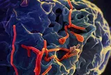 Bộ Y tế thông tin diễn biến phức tạp của dịch bệnh do virus Ebola