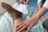 Bị rắn độc cắn khi đang cấy lúa, người đàn ông làm 1 việc khiến bác sĩ khen ngợi
