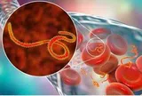 Dịch bệnh Ebola tiếp tục diễn biến phức tạp