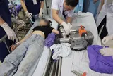 Một phút bất cẩn, cô gái 19 tuổi đối mặt biến cố lớn