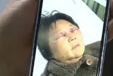 Từ chối chăm cháu, mẹ chồng bị con dâu hành hung đến gãy xương sườn