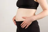Tưởng béo bụng, người phụ nữ 42 tuổi sốc nặng khi phát hiện thứ "đáng sợ" rải rác trong tử cung