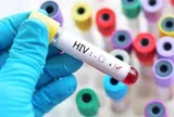 Quy định mới về cấp giấy chứng nhận bị phơi nhiễm HIV do tai nạn rủi ro nghề nghiệp