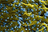 Phát hiện ca nhiễm virus Marburg tại Uganda