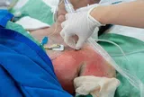 Tình trạng sức khỏe các nạn nhân vụ cháy nhà khiến 2 người tử vong