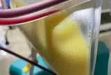 Người phụ nữ 30 tuổi "máu trắng đục như sữa" vì thói quen nhiều người mắc mà không hay