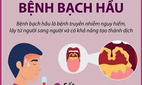 Triệu chứng của bệnh bạch hầu