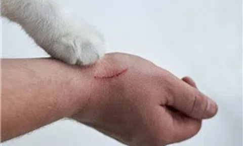 Đắk Lắk tăng cường giám sát ổ dịch dại trên người 