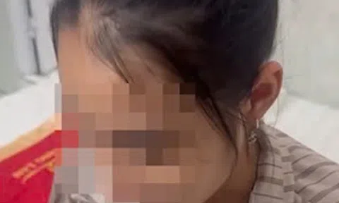 Dính bẫy lừa quen thuộc, nữ sinh tự thuê khách sạn rồi gọi cho mẹ nói bị bắt cóc