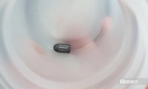 Hy hữu người phụ nữ bất ngờ bị vật lạ nghi đầu đạn găm vào đầu