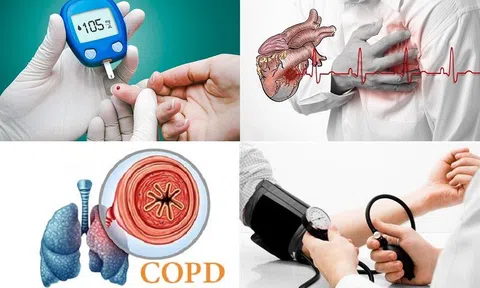 Sàng lọc sớm - Lá chắn vàng giúp giảm gánh nặng bệnh không lây nhiễm