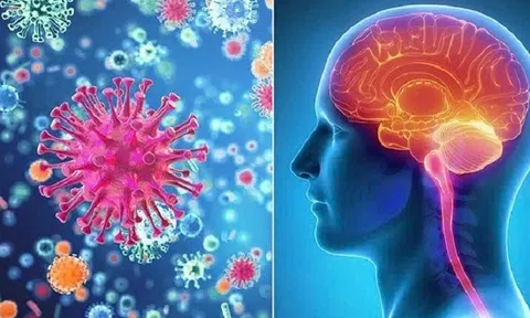 Cảnh báo các ca bệnh não mô cầu xâm lấn: Bệnh không phổ biến nhưng rất nguy hiểm