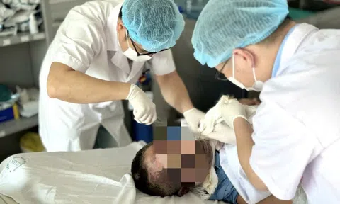 Giữ thang giúp hàng xóm, người đàn ông nhập viện với 30% cơ thể bỏng rộp