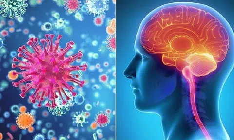 Bệnh não mô cầu nhóm B - mối đe dọa sức khỏe cộng đồng