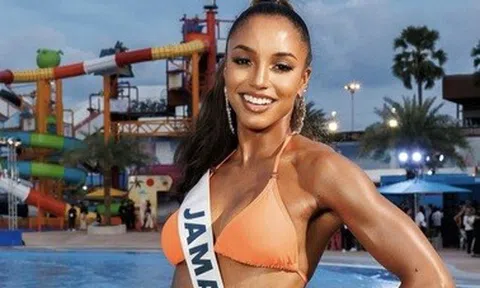 Tai nạn tại Hoa hậu Hoàn vũ: Thí sinh chưa xuất viện, bị chấn thương hộp sọ