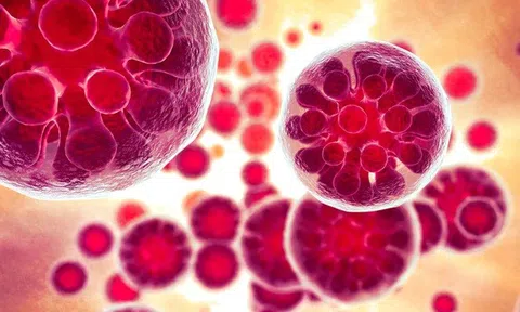 Nhiễm trùng nấm khiến 1 người nguy kịch và 18 ca mắc bệnh