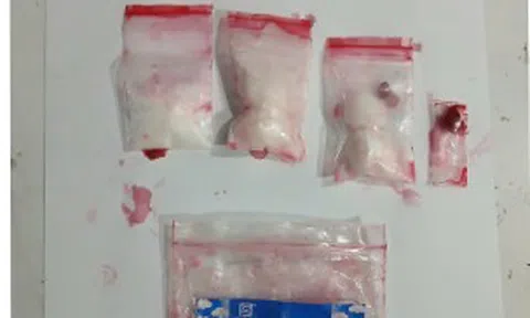 Vật thể trong bồn cầu "bóc trần" hành vi sai trái của thiếu niên 17 tuổi