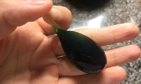 Người đàn ông 38 tuổi suýt chết vì nuốt mật cá trắm để "tăng cường sinh lực"