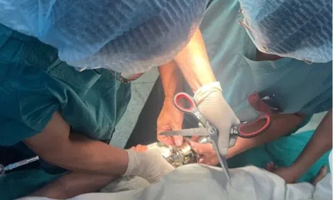 Bé trai 5 tuổi "ôm" ổ khóa nhập viện cấp cứu, bác sĩ phát cảnh báo khẩn