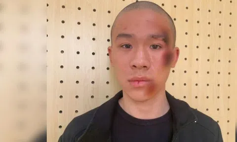 Tạm giữ hình sự đối tượng "trẻ trâu" lao xe “thông chốt” khiến CSGT bị thương