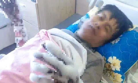 Bị phóng điện, người đàn ông bỏng nặng cả hai tay