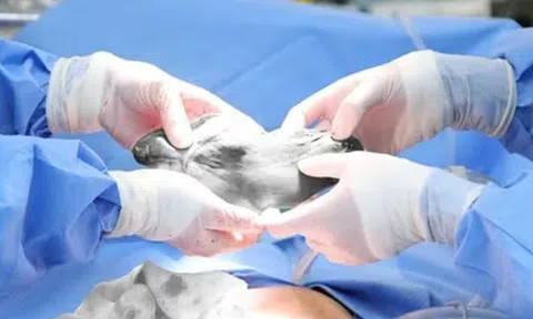 Đau bụng kéo dài, người phụ nữ đi khám phát hiện bí mật đáng sợ