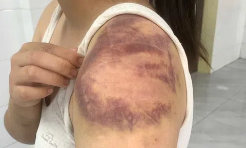 Bắt đối tượng ngược đãi, hành hạ vợ và con gái