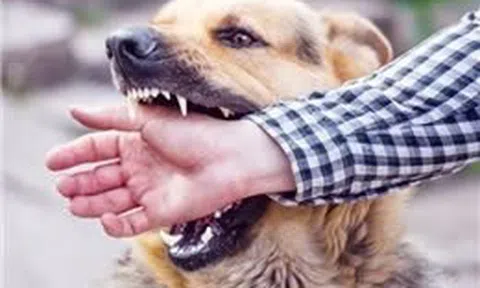 TP Hồ Chí Minh: Người đàn ông tử vong do bệnh dại sau khi bị chó cắn