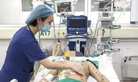 Gia tăng ca mắc thủy đậu, cảnh báo nguy cơ biến chứng nặng