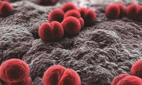 Viêm màng não mô cầu "sát thủ 24 giờ", bác sĩ cảnh báo nguy cơ