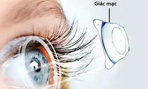 Tìm giải pháp giúp hơn 500.000 người chờ ghép giác mạc