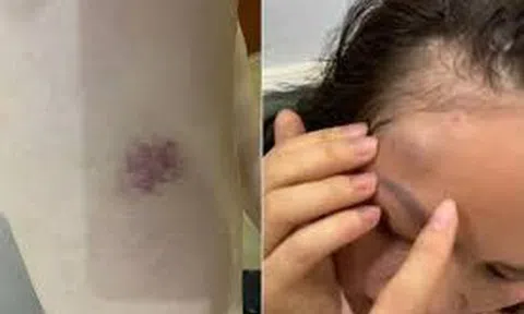 Hà Nội: Công an vào cuộc vụ một gia đình tố bị hàng xóm liên tục đe dọa, hành hung