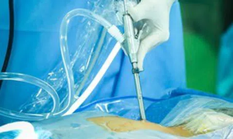 Bệnh lý cột sống: Bước tiến khoa học từ các kỹ thuật ít xâm lấn thế hệ mới