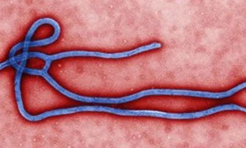 Bộ Y tế tăng cường giám sát trước nguy cơ dịch Ebola