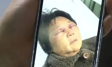 Từ chối chăm cháu, mẹ chồng bị con dâu hành hung đến gãy xương sườn