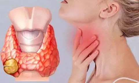 Có những biểu hiện này, đừng chủ quan vì có thể là dấu hiệu ung thư