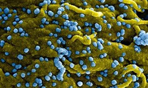 Phát hiện ca nhiễm virus Marburg tại Uganda