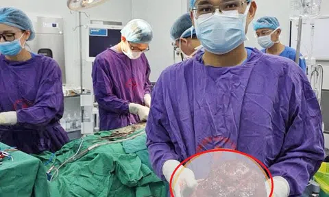 Bụng to bất thường, người đàn ông sốc khi bác sĩ gắp ra thứ "đáng sợ" nặng 2kg bên trong