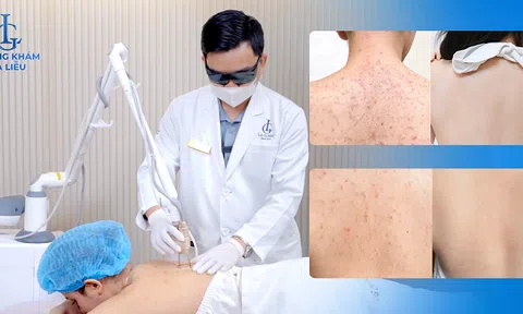 Những lý do Phòng khám Da liễu LG trở thành địa chỉ điều trị viêm nang lông hàng đầu hiện nay