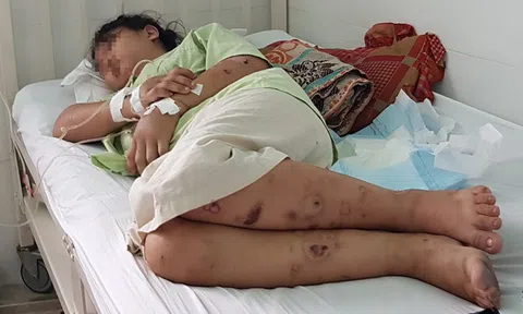 Rùng rợn lời kể của thai phụ bị đánh sẩy thai trong 20 ngày giam cầm