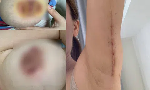Viện thẩm mỹ SIAM Thailand làm khổ khách hàng?