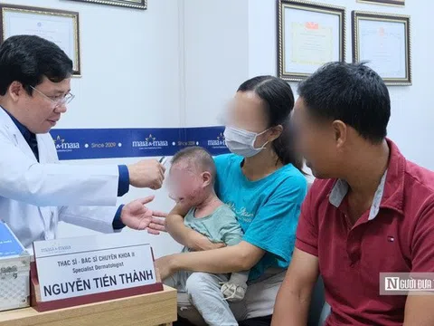 Bé 1 tuổi phồng rộp cả mặt chỉ vì hành động thường ngày, bác sĩ nói gì?