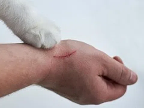 Đắk Lắk tăng cường giám sát ổ dịch dại trên người 