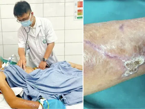 Cụ bà 90 tuổi mắc uốn ván, 5 người con tức tốc đi tiêm phòng