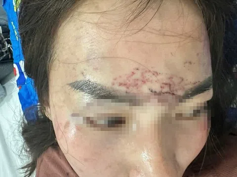 Diễn biến mới vụ người phụ nữ bị cắt tóc, xăm mặt ở Cà Mau