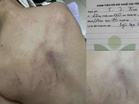 Vụ cháu bé 4 tuổi bị đánh, ném vào tường ở Hà Nội: Cô giáo bạo hành nói gì?